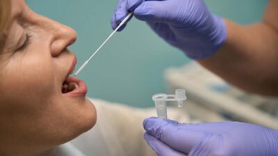 Prueba con cepillado detecta cáncer de boca en menos de una hora