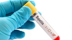 Gran Bretaña: Descubren el origen de múltiples casos de Hepatitis en niños