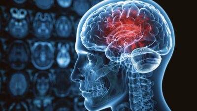 Así se recupera el cerebro cuando se deja de consumir alcohol