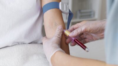Análisis de sangre podría mejorar el pronóstico de pacientes que sufren un infarto