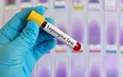 Brigadas de prevención de Leptospirosis en época lluviosa