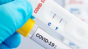 MINSA reporta 11 nuevos casos de COVID-19 atendidos durante la última semana
