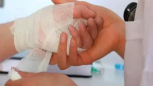 Hospital Fernando Vélez Paiz realizará simposio sobre quemaduras