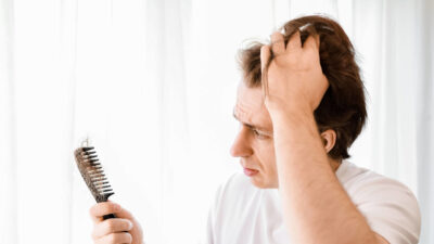Ciertos fármacos podrían aumentar el riesgo de pérdida de cabello en hombres