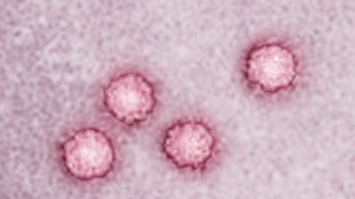 Estas cinco infecciones están relacionadas con millones de casos de cáncer