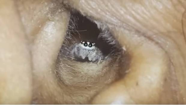 araña