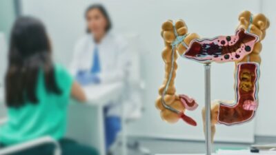 ¿Problemas digestivos? Estos alimentos podrían ser la causa
