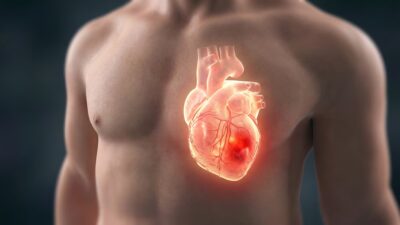 Estas son las señales y estudios que pueden ayudar a prevenir un infarto