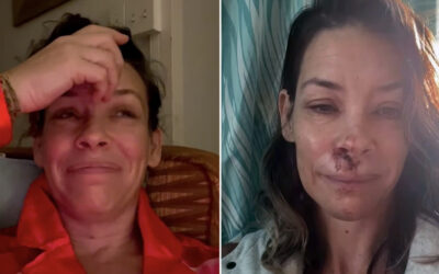 Una actriz de ‘El hobbit’ y Marvel sufre daño cerebral tras grave caída