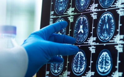 Los consejos de la ciencia para tener un cerebro hasta 8 años más joven