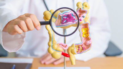 Dos nutrientes clave para reforzar la salud del colon contra el cáncer