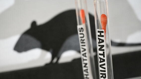 Hantavirus 