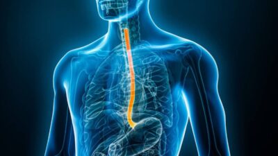 Adiós al reflujo: Descubren cómo evitar que cause cáncer