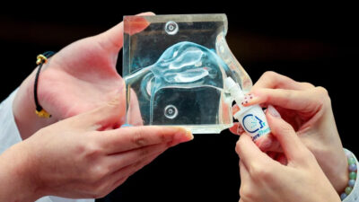 China desarrolla el primer aerosol nasal para tratar el ictus