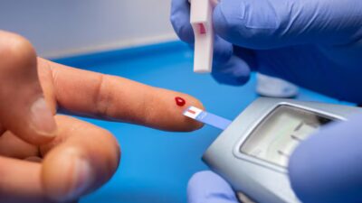 Por qué medir la glucosa puede ser útil incluso sin usar insulina