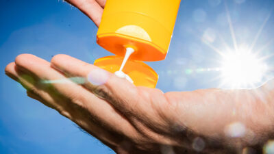 Oncólogo aclara si el protector solar causa cáncer de piel