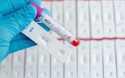 Rusia lanza primera prueba rápida del mundo contra la hepatitis C