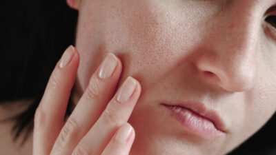 Déficit de hierro: ¿Qué dice la ciencia sobre el “rostro de ferritina”?