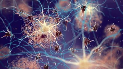 Descubren cómo el Alzheimer se transmite entre neuronas