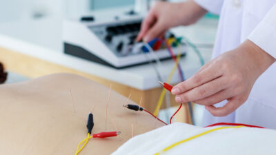 Rusia autoriza terapia electroconvulsiva contra la depresión